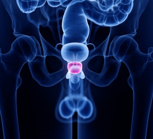 lagodny przerost prostaty znamlek