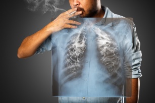 Badania profilaktyczne dla palaczy i eks-palaczy. Zbadaj się, aby wyprzedzić chorobę!